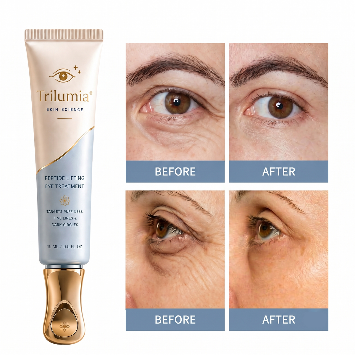 🔥 𝐅𝐥𝐚𝐬𝐡 𝐒𝐚𝐥𝐞: 𝟕𝟎% 𝐎𝐅𝐅 –𝐓𝐫𝐢𝐥𝐮𝐦𝐢𝐚® 𝐈𝐧𝐬𝐭𝐚𝐧𝐭 𝐅𝐚𝐜𝐞 𝐓𝐞𝐦𝐩𝐨𝐫𝐚𝐫𝐲 𝐓𝐢𝐠𝐡𝐭𝐞𝐧𝐞𝐫 – 𝐈𝐧𝐬𝐭𝐚𝐧𝐭 𝐯𝐢𝐬𝐢𝐛𝐥𝐞 𝐫𝐞𝐬𝐮𝐥𝐭𝐬 𝐢𝐧 𝟑𝟎 𝐬𝐞𝐜𝐨𝐧𝐝𝐬
